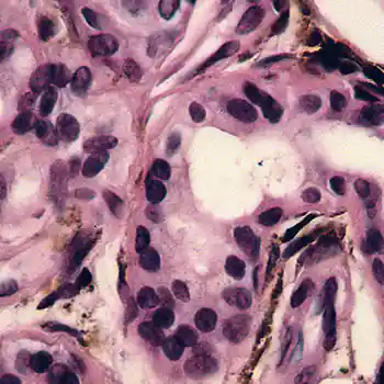 клетки, наполненные пигментом в коже